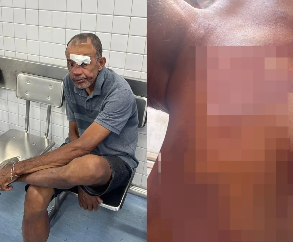 Adilson Alves: agredido após acusação de furto na Praia do Futuro