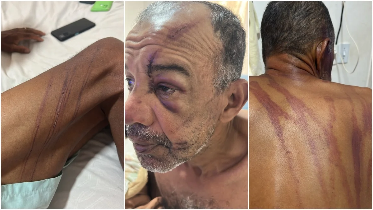 Adilson Viana: atacado por quatro seguranças na Praia do Futuro