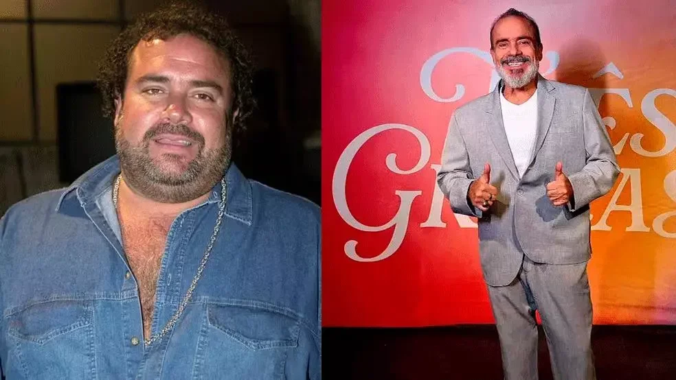 André Mattos perde 65 kg e peito peludo vira sucesso