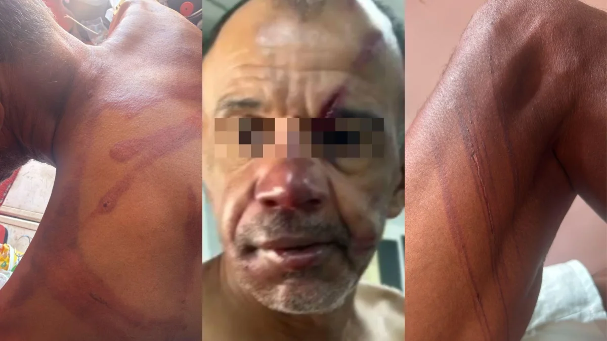 Complexo Crocobeach: homem de 53 anos denuncia racismo e espancamento