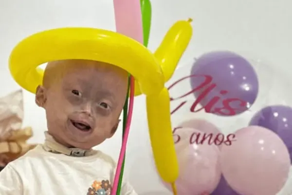 Elis Lima Carneiro morre aos 5 anos por infecção pulmonar