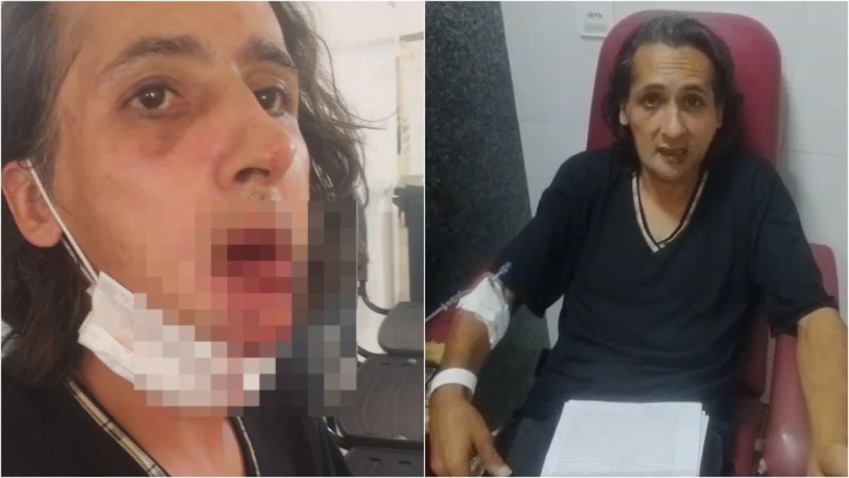 Fernando Lemons Francisco: perdeu todos os dentes e pede R$1,9 mi à Cooperita