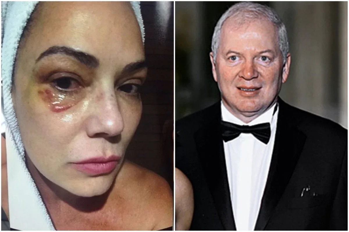 Luiza Brunet recebe R$ 150 mil por agressão cometida em Nova York