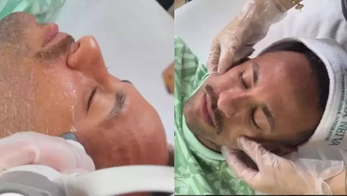 Neymar adota tecnologia XERF para rejuvenescer a pele
