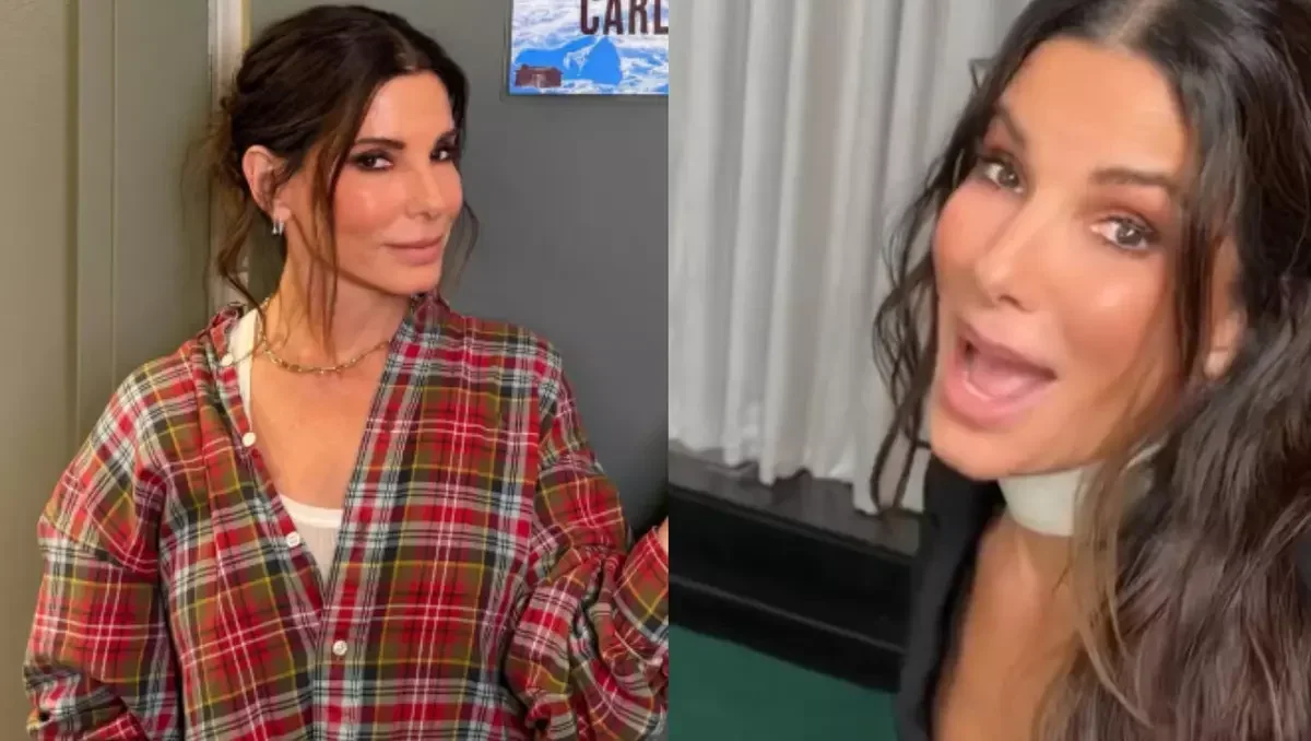 Sandra Bullock revela queda de cabelo; médico alerta para eflúvio